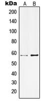 IHC-plus™ KCNC1 / Kv3.1 Antibody (Internal)
