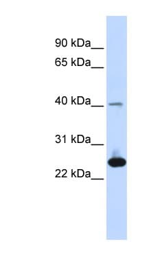 Polyclonal Rabbit anti-Human SELS Antibody (aa72-121, IHC, WB)