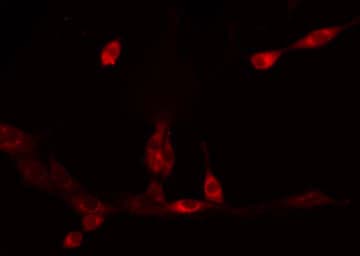 P450SCC / CYP11A1 Antibody