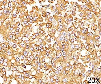 HMB45 Antibody (clone HMB45, Ready-to-Use)