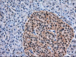 ERIC-1 / TACC3 Antibody (clone OTI7B11)