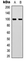 ACO1 / Aconitase Antibody (C-Terminus)