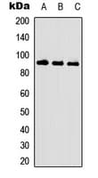 PR / Progesterone Receptor Antibody (phospho-Ser190)