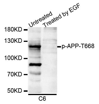 APP / Beta Amyloid Precursor Antibody (phospho-Thr743)