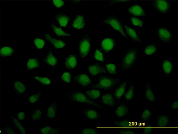 RAD51C Antibody (clone 3F3-5C6)