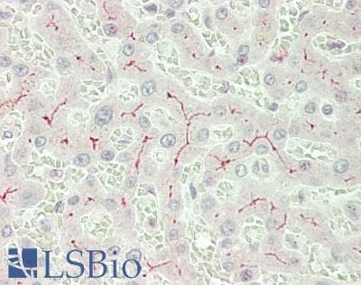 IHC-plus™ ABCC2 / MRP2 Antibody (Internal)