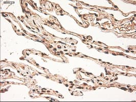 Monoclonal Mouse anti-Human MYC / c-Myc Antibody (clone OTI1A6, IHC, IF, WB)