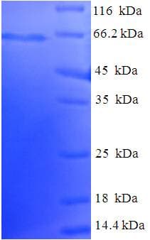 Human EML2 / EMAP2 Protein (Recombinant His-SUMO)