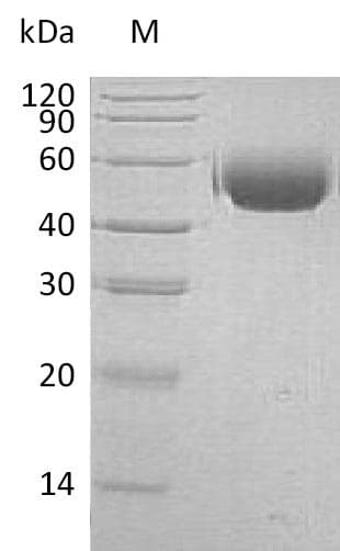 Human SIRPA / CD172a Protein (Recombinant 6His, C-terminus)