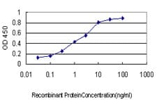 IHC-plus™ Monoclonal Mouse anti-Human GTF2I / TFII I Antibody (clone 3E2, IHC, IF, WB)