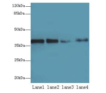 MRPL44 Antibody