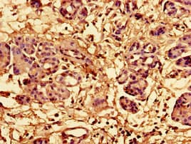RPL28 / Ribosomal Protein L28 Antibody