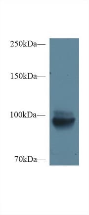 MEP1A / Meprin Alpha Antibody (aa219-463)