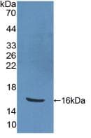 PPARG / PPAR Gamma Antibody (aa157-274)
