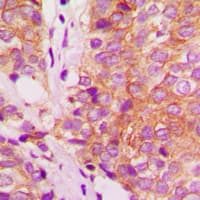 FLNA / Filamin A Antibody (C-Terminus)