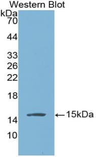 NPPB / BNP Antibody (aa27-134)