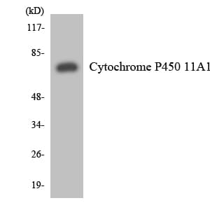 P450SCC / CYP11A1 Antibody (aa398-447)