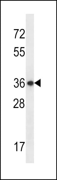 EAPP Antibody (aa204-233)