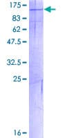 Human PKN3 Protein (Recombinant GST)