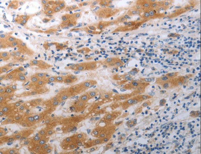 SLC12A6 / KCC3 Antibody