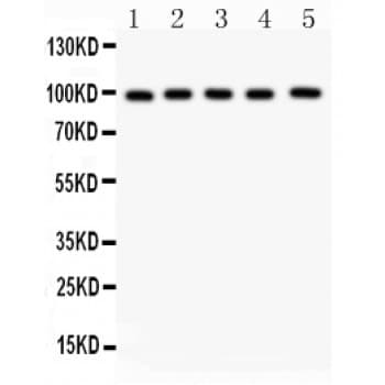 Junctin / ASPH Antibody (aa726-758)