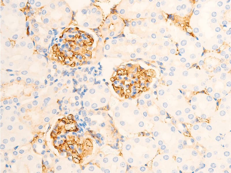 Polyclonal Rabbit anti-Human NFKBIE / IKB Epsilon Antibody (phospho-Ser22, IHC, IF, WB)