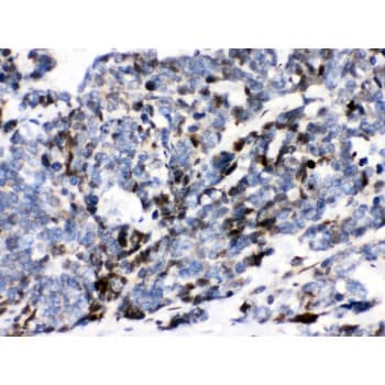 Polyclonal Rabbit anti-Human ATXN1 / SCA1 Antibody (aa778-808, IHC, WB)