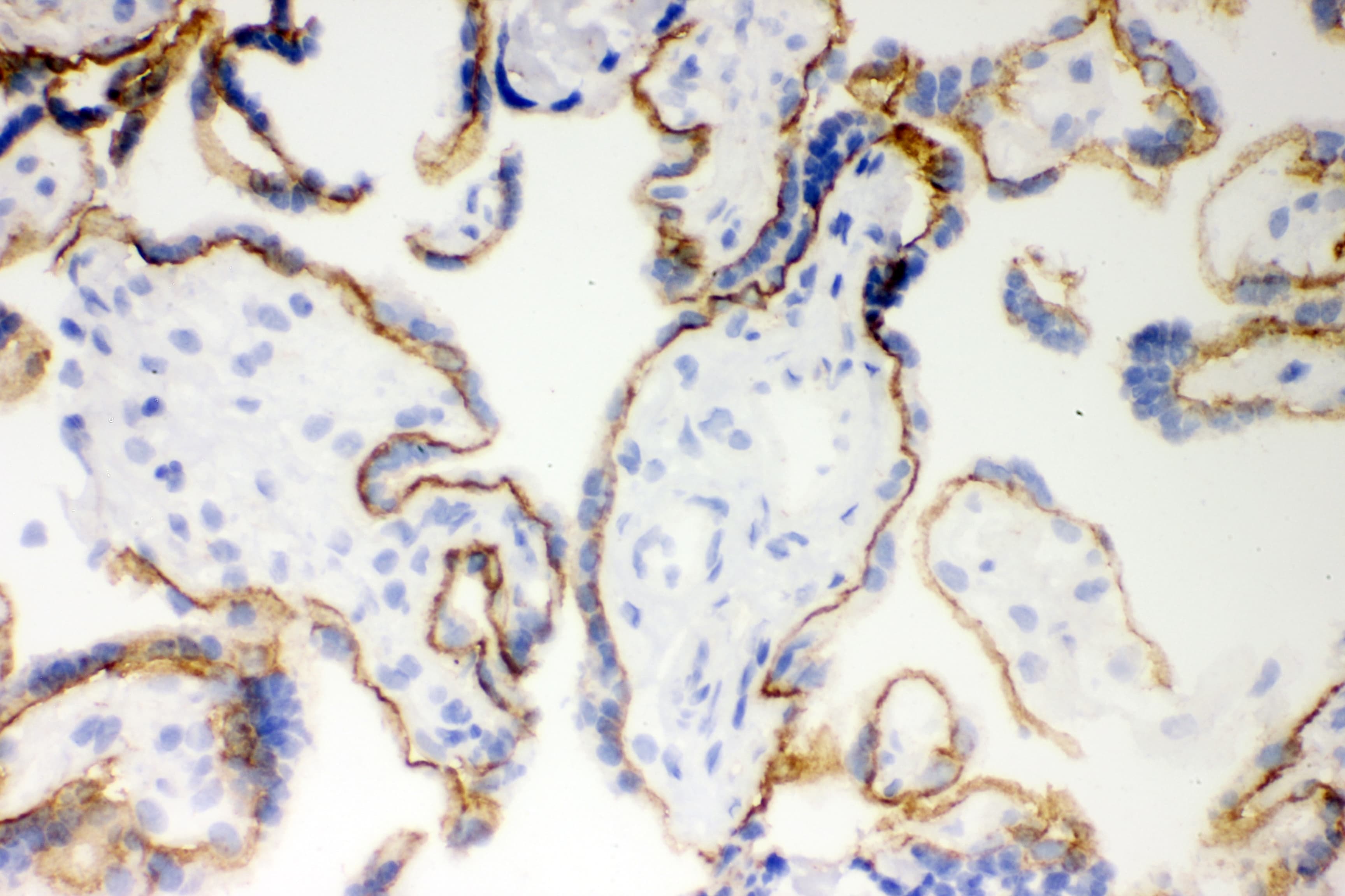 CDH1 / E Cadherin Antibody (aa286-703)