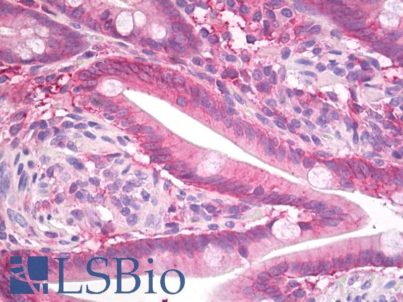 IHC-plus™ Polyclonal Rabbit anti-Human SDC1 / Syndecan 1 / CD138 Antibody (Internal, IHC, WB)