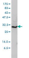 Monoclonal Mouse anti-Human STX6 / Syntaxin 6 Antibody (clone 1G2, IF, WB)