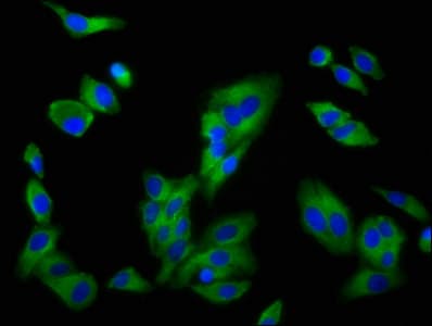 Polyclonal Rabbit anti-Human SLC16A12 / MCT12 Antibody (IHC, WB)