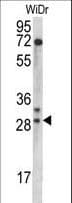 MRPL9 Antibody (aa66-95)