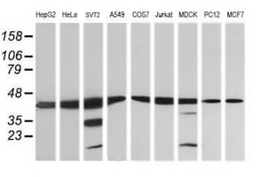 MAP2K1 / MKK1 / MEK1 Antibody (clone OTI5A11)