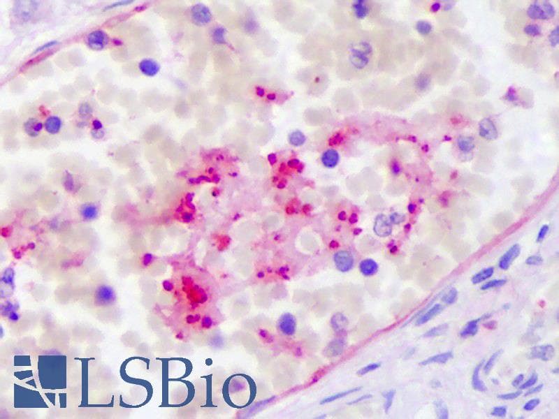 IHC-plus™ CXCL7 / PPBP Antibody