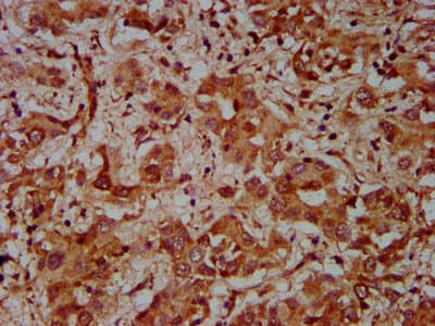 CUL7 Antibody