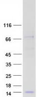 Human PLAC9 Protein (Recombinant Myc-DDK (Flag))