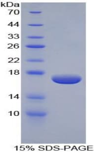 Human Epsin 1 / EPN1 Protein (Recombinant His, N-Terminal)