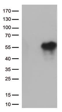 HAVCR2 / TIM-3 Antibody (clone OTI2B9)