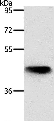 NKX2-1 / Thyroid-Specific TF Antibody