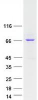 Human ANKRD13B Protein (Recombinant Myc-DDK (Flag))