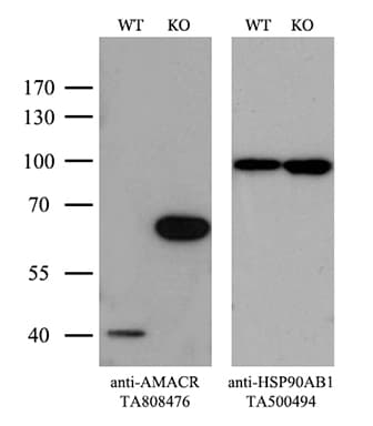 AMACR / P504S Antibody (clone OTI3E10)