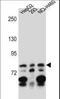 ZNF555 Antibody (aa592-620)