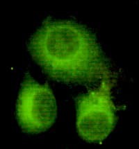 Monoclonal Mouse anti-Human ACLY / ATP Citrate Lyase Antibody (WB)