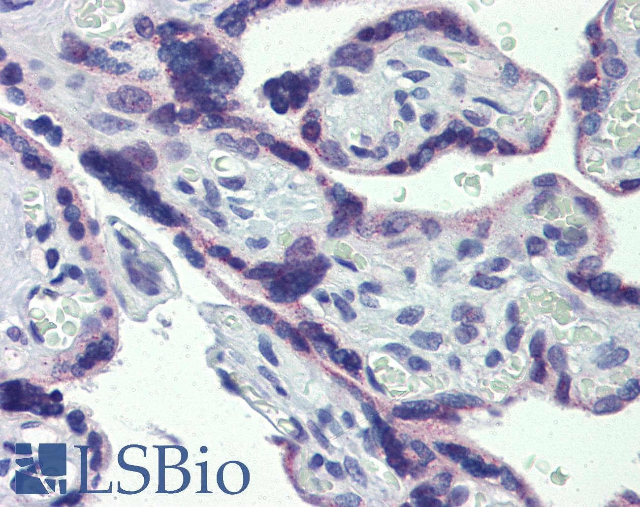 STAT5B Antibody (N-Terminus)