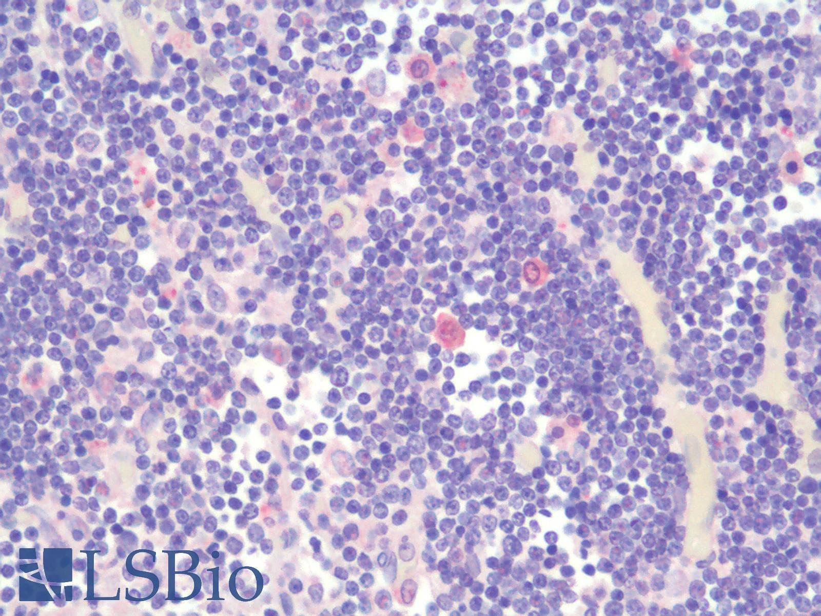IHC-plus™ TIGIT Antibody