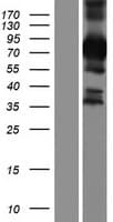 CCDC64 Protein (Over-Expression Lysate Myc-DDK (Flag))