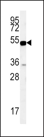 Polyclonal Rabbit anti-Human SLC9A3R1 / NHERF1 / EBP50 Antibody (aa168-197, WB)