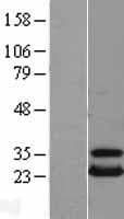 UBE2T / HSPC150 Protein (Over-Expression Lysate Myc-DDK (Flag))