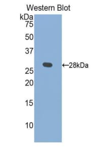 KLK1 / Kallikrein 1 Antibody (aa25-261)