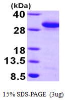 Human RAB27A / RAB27 Protein (Recombinant His)